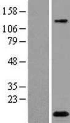 Western Blot: C2orf88 Overexpression Lysate [NBL1-13058]