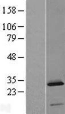 Western Blot: C2orf88 Overexpression Lysate [NBL1-13059]