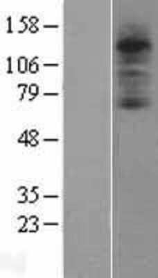 Western Blot: Complement Component C3aR Overexpression Lysate [NBP2-04261]