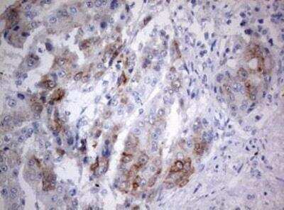 Immunohistochemistry-Paraffin: MAATS1 Antibody (OTI6G1) [NBP2-45449]