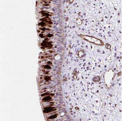 Immunohistochemistry: ANKUB1 Antibody [NBP2-30502]