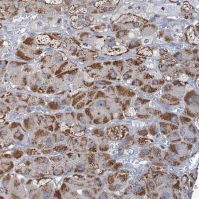Immunohistochemistry-Paraffin: C3orf18 Antibody [NBP1-83405]