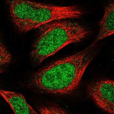 Immunocytochemistry/ Immunofluorescence: CCDC174 Antibody [NBP2-14409]