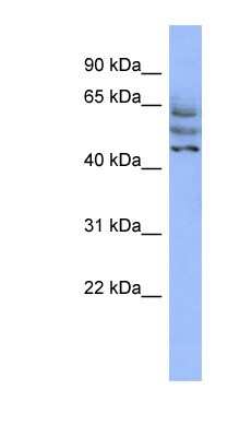 Western Blot: CCDC174 Antibody [NBP1-70470]