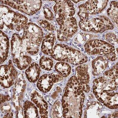 Immunohistochemistry: C3orf20 Antibody [NBP1-90545]