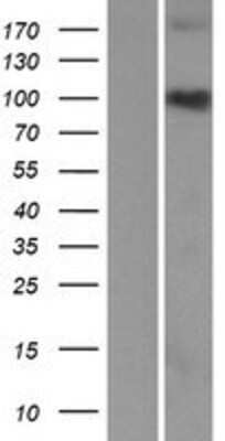 Western Blot: C3orf20 Overexpression Lysate [NBP2-06076]