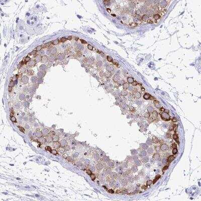 Immunohistochemistry-Paraffin: C3orf22 Antibody [NBP2-31754]