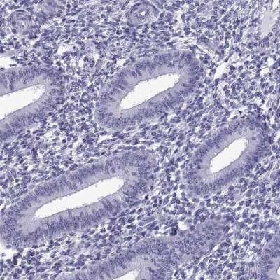 Immunohistochemistry-Paraffin: C3orf22 Antibody [NBP2-31754]