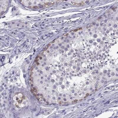 Immunohistochemistry-Paraffin: C3orf22 Antibody [NBP2-31754]