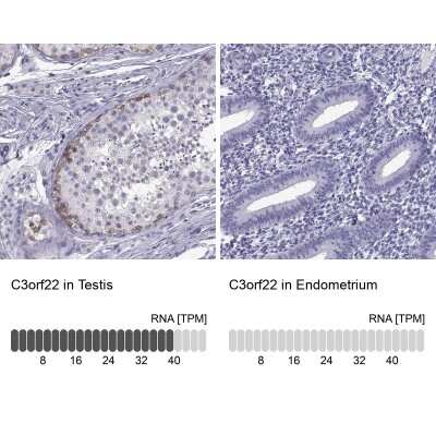 Immunohistochemistry-Paraffin: C3orf22 Antibody [NBP2-31754]