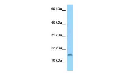 Western Blot: C3orf22 Antibody [NBP2-82898]