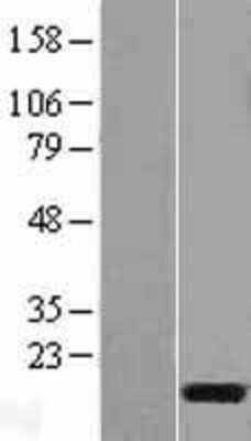 Western Blot: C3orf22 Overexpression Lysate [NBL1-08438]