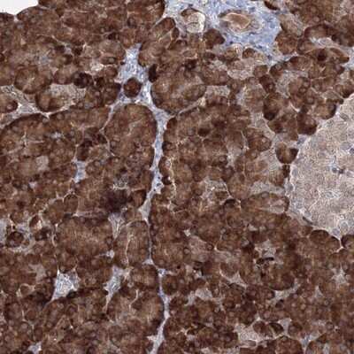 Immunohistochemistry-Paraffin: EFCAB12 Antibody [NBP1-85882]