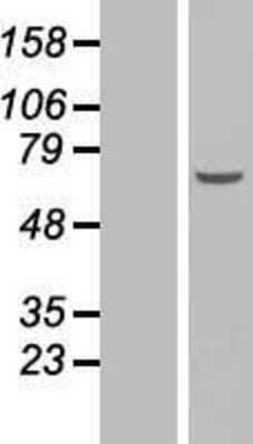 Western Blot: EFCAB12 Overexpression Lysate [NBL1-08440]