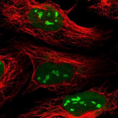 Immunocytochemistry/ Immunofluorescence: CMSS1 Antibody [NBP1-81078]