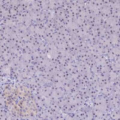 Immunohistochemistry-Paraffin: CMSS1 Antibody [NBP1-81078]
