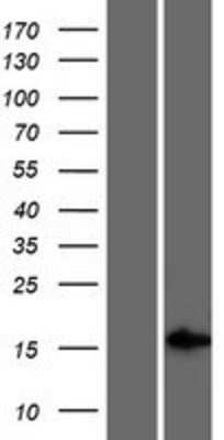 Western Blot: GR6 Overexpression Lysate [NBP2-07502]