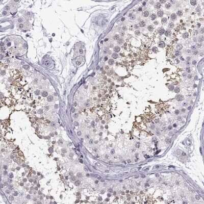 Immunohistochemistry-Paraffin: TEX55 Antibody [NBP2-37991]