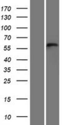 Western Blot: TEX55 Overexpression Lysate [NBP2-05341]