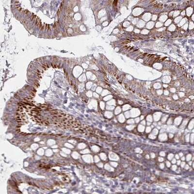 Immunohistochemistry-Paraffin: C3orf36 Antibody [NBP2-14569]