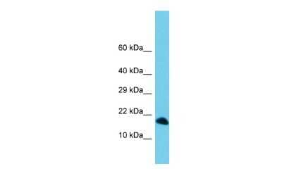 Western Blot: C3orf36 Antibody [NBP2-84558]