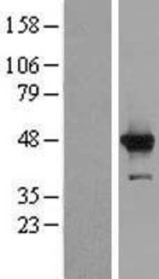 Western Blot: HMCES Overexpression Lysate [NBP2-06680]