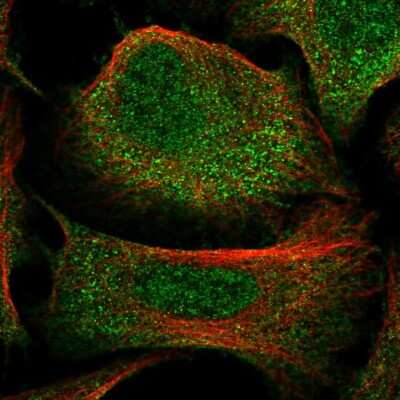 Immunocytochemistry/ Immunofluorescence: C3orf38 Antibody [NBP2-48626]