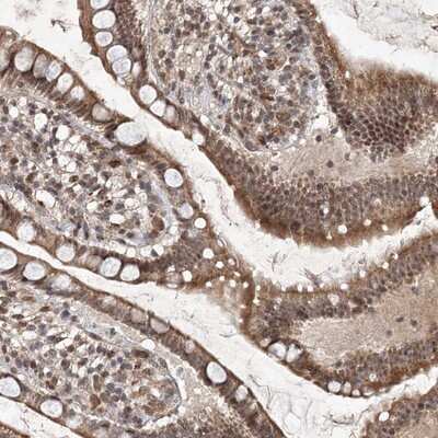 Immunohistochemistry-Paraffin: C3orf38 Antibody [NBP1-81147]