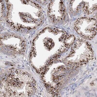 Immunohistochemistry-Paraffin: C3orf38 Antibody [NBP2-48626]
