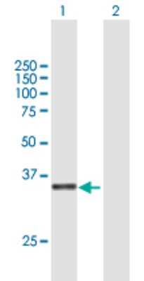 Western Blot: C3orf38 Antibody [H00285237-B01P]