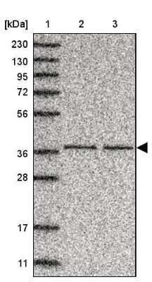 Western Blot: C3orf38 Antibody [NBP1-81147]