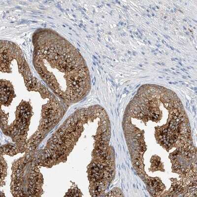 Immunohistochemistry-Paraffin: POMGNT2 Antibody [NBP1-89205]