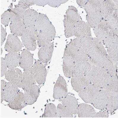 Immunohistochemistry-Paraffin: POMGNT2 Antibody [NBP2-34067]