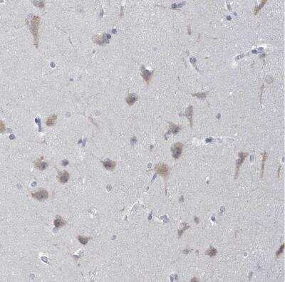 Immunohistochemistry-Paraffin: POMGNT2 Antibody [NBP2-34067]