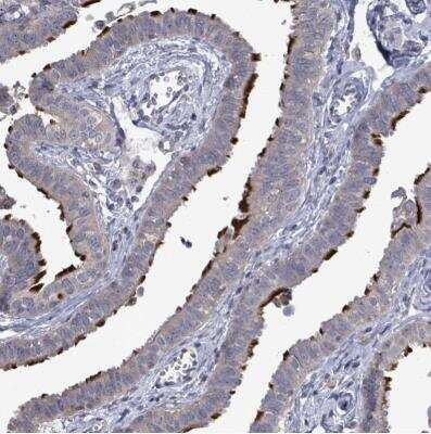 Immunohistochemistry-Paraffin: POMGNT2 Antibody [NBP2-34067]