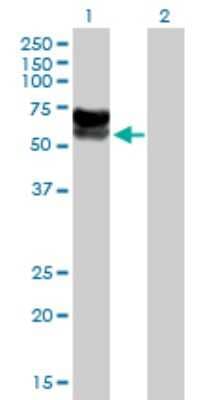 Western Blot: POMGNT2 Antibody [H00084892-B01P]