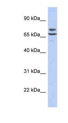 Western Blot: POMGNT2 Antibody [NBP1-79304]