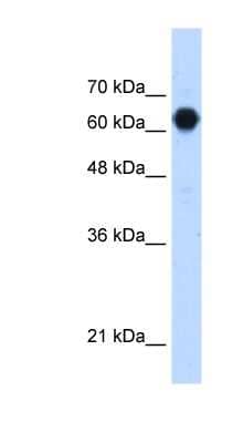 Western Blot: POMGNT2 Antibody [NBP1-79305]