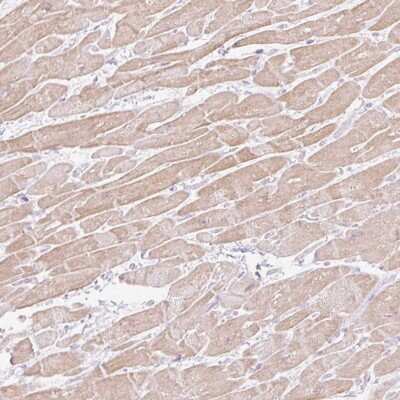 Immunohistochemistry: C3orf49 Antibody [NBP2-49091]