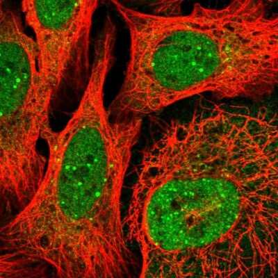 Immunocytochemistry/ Immunofluorescence: PQLC2L Antibody [NBP2-14781]