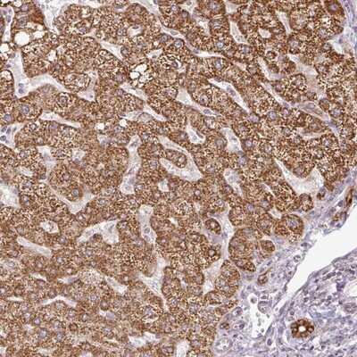 Immunohistochemistry-Paraffin: PQLC2L Antibody [NBP2-14781]
