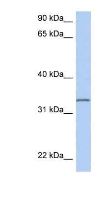 Western Blot: C3orf62 Antibody [NBP1-70473]