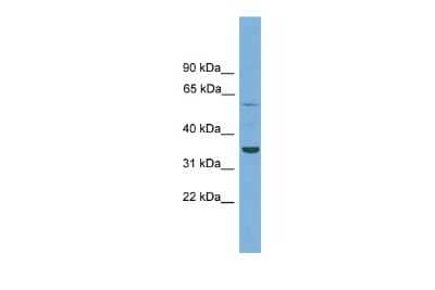 Western Blot: C3orf67 Antibody [NBP2-82906]