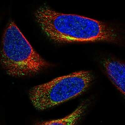 Immunocytochemistry/ Immunofluorescence: C3orf70 Antibody [NBP1-86223]