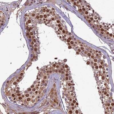 Immunohistochemistry-Paraffin: C3orf70 Antibody [NBP1-86223]