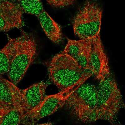 Immunocytochemistry/ Immunofluorescence: TMEM103 Antibody [NBP2-55872]