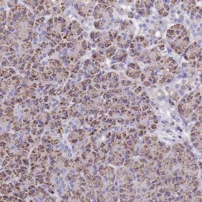 Immunohistochemistry-Paraffin: TMEM103 Antibody [NBP1-91733]