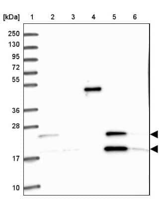 Western Blot: TMEM103 Antibody [NBP1-91733]
