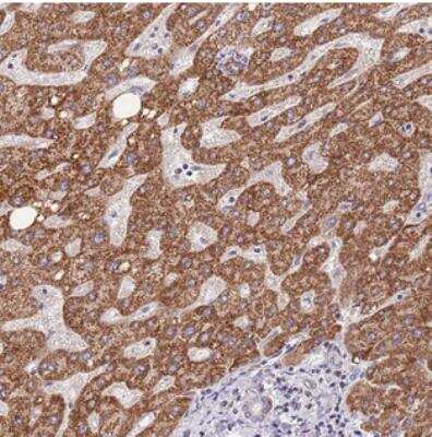Immunohistochemistry: TOPAZ1 Antibody [NBP2-30805]