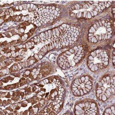 Immunohistochemistry: TOPAZ1 Antibody [NBP2-30863]